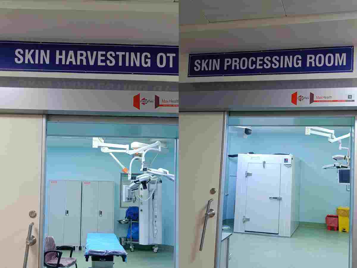 Safdarjung Hospital’s skin bank up and running