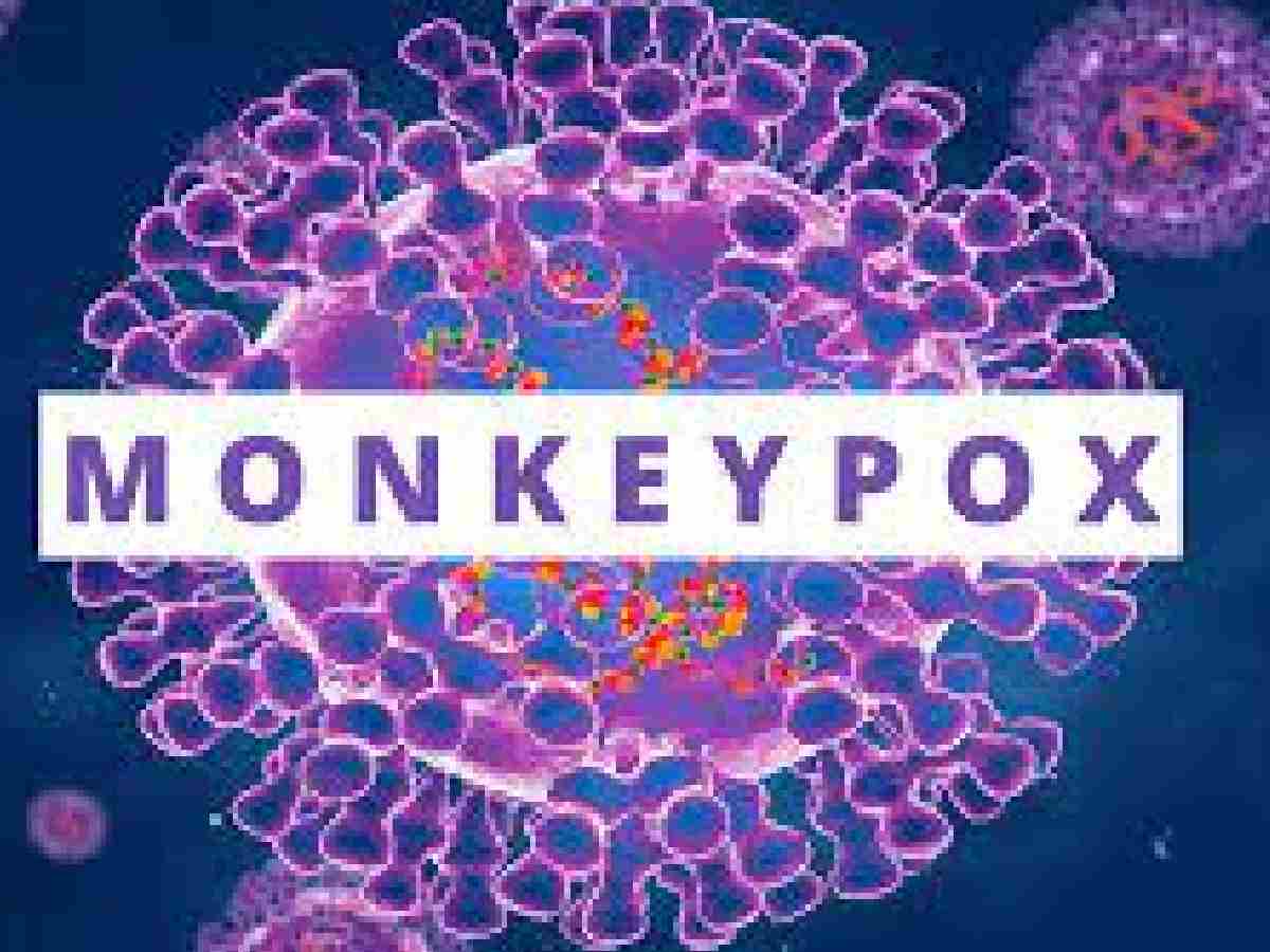 Monkey Pox