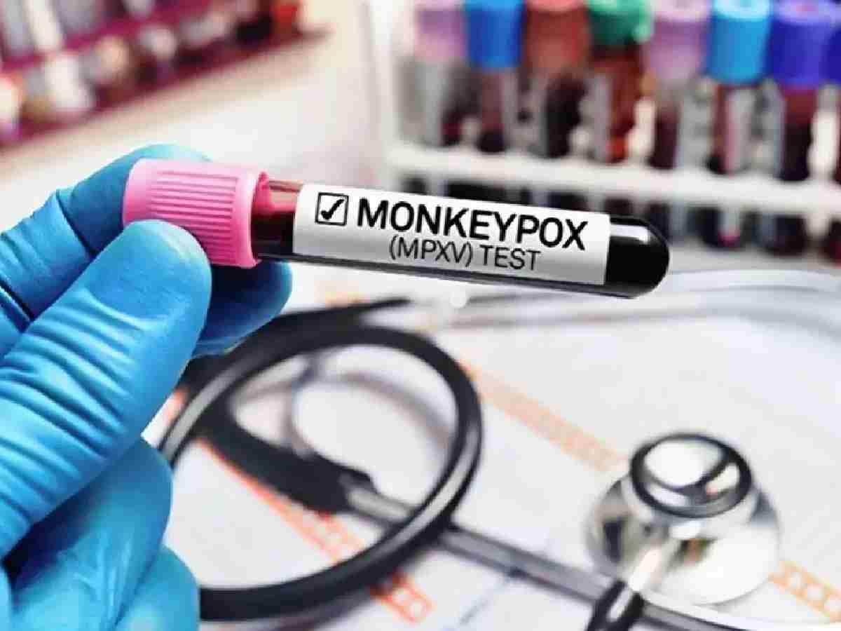 Monkeypox: AIIMS Delhi issues treatment guidelines, sets aside five beds for isolation