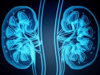 Dehydration, poor diet, and sedentary lifestyles: Key risks to kidney health