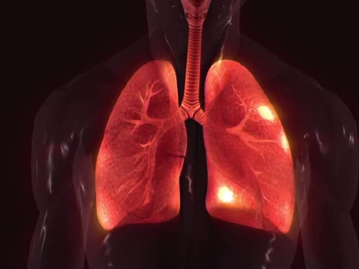 Delhi pollution drives unprecedented rise in COPD cases