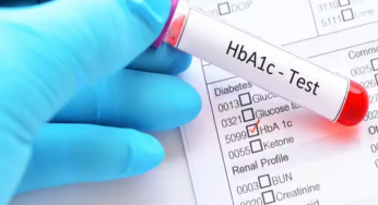 Diabetes: HbA1c may be misleading millions in South Asia, warn experts