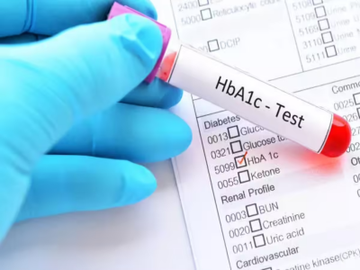 Diabetes: HbA1c may be misleading millions in South Asia, warn experts