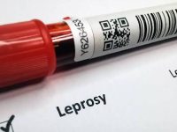 Delhi govt set to declare leprosy a notifiable disease