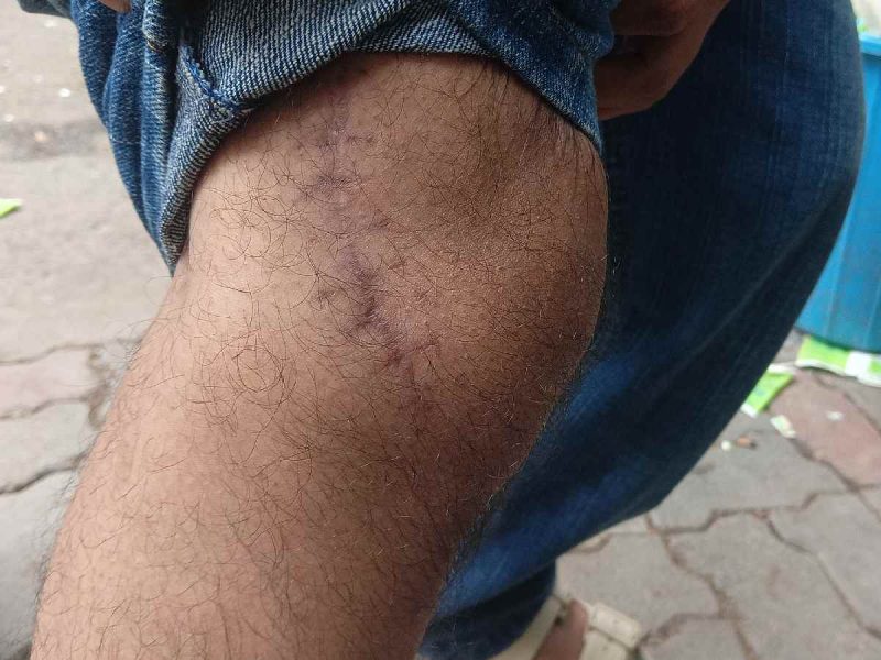 Gahral's stitches, still fresh, were injured once again